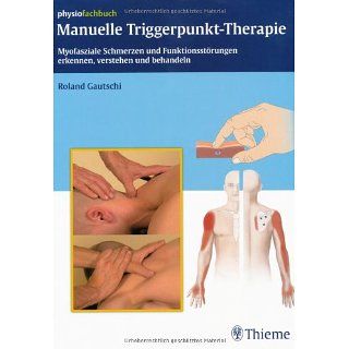 Manuelle Triggerpunkt Therapie Myofasziale Schmerzen und